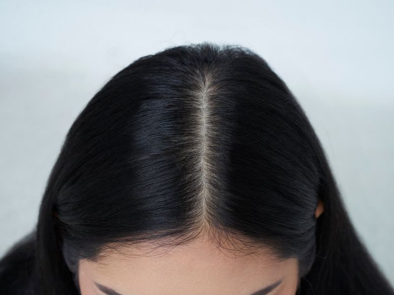 A woman showing her healthy scalp